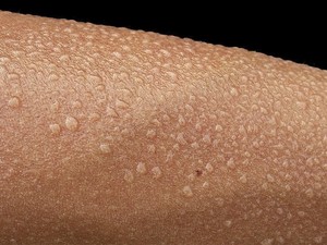 Suor Odor animal negativo, característico dos vinhos muito reduzidos, que recorda o do suor. 
