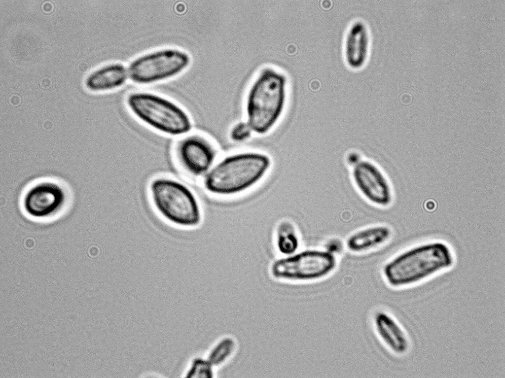 Brettanomyces bruxellensis 1000x